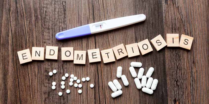Endometriosis1