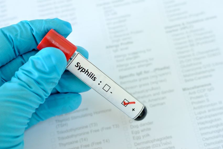 Ministry of Health: Increase in syphilis cases