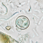 No cases of cyclosporiasis in Barbados, says Ministry of Health